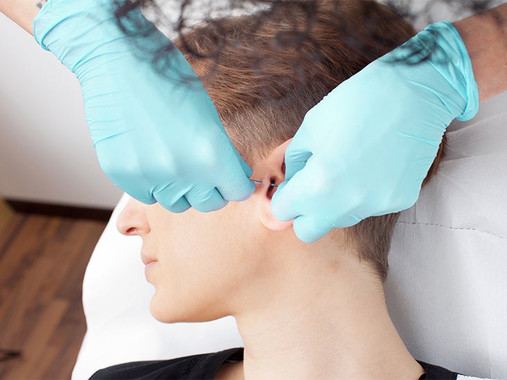 Tragus Piercing 12 FAQs zu Nutzen, Kosten, mehr