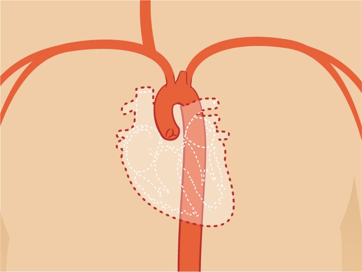 Aortic Arch Anatomy Function Definition Body Maps