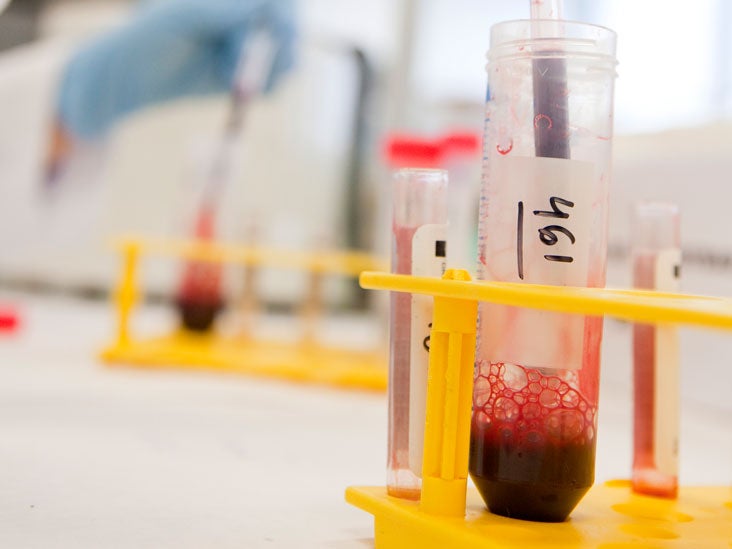 Retikulozytenzahl Zweck, Verfahren und Ergebnisse