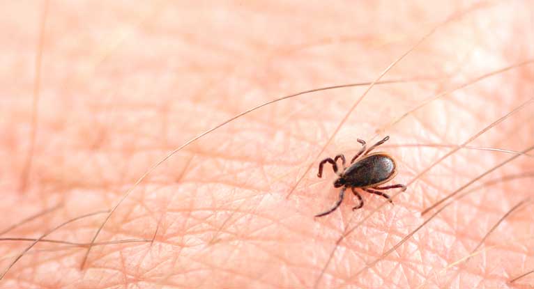 Lyme Borreliose Alle Symptome