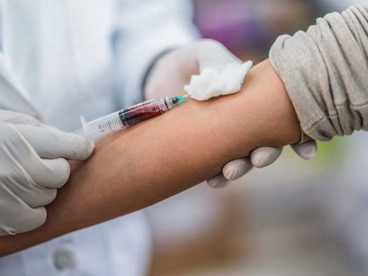 CPeptidTest Zweck, Herstellung, Ergebnisse und mehr