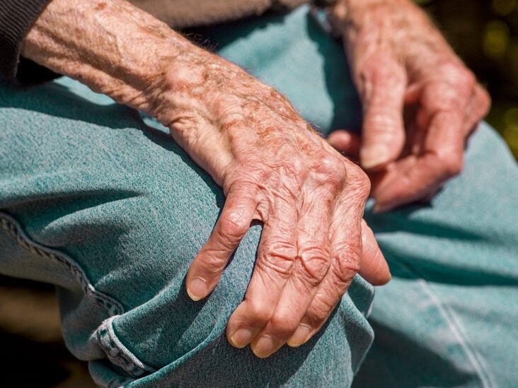 Rheumatoid Arthritis | Deldunantulifurdok