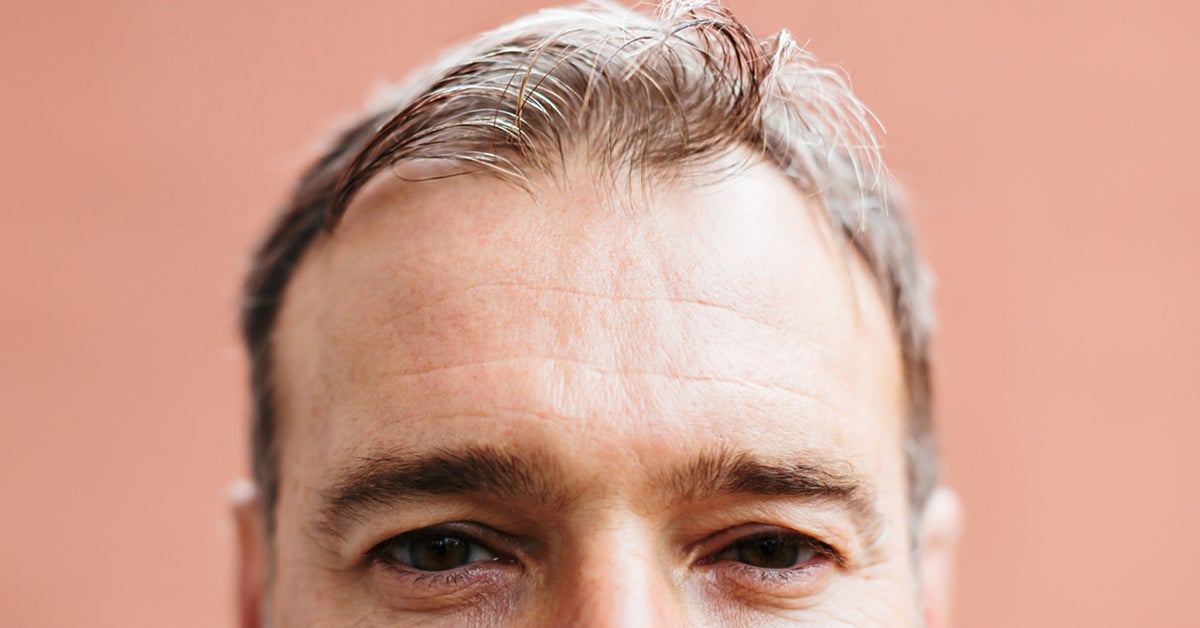 Medications That Cause Hair Loss List What You Can Do And More