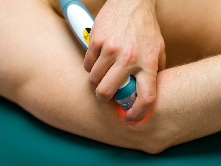 Cold Laser Therapy: Procedure, Purpose, Pros/Cons, and More
