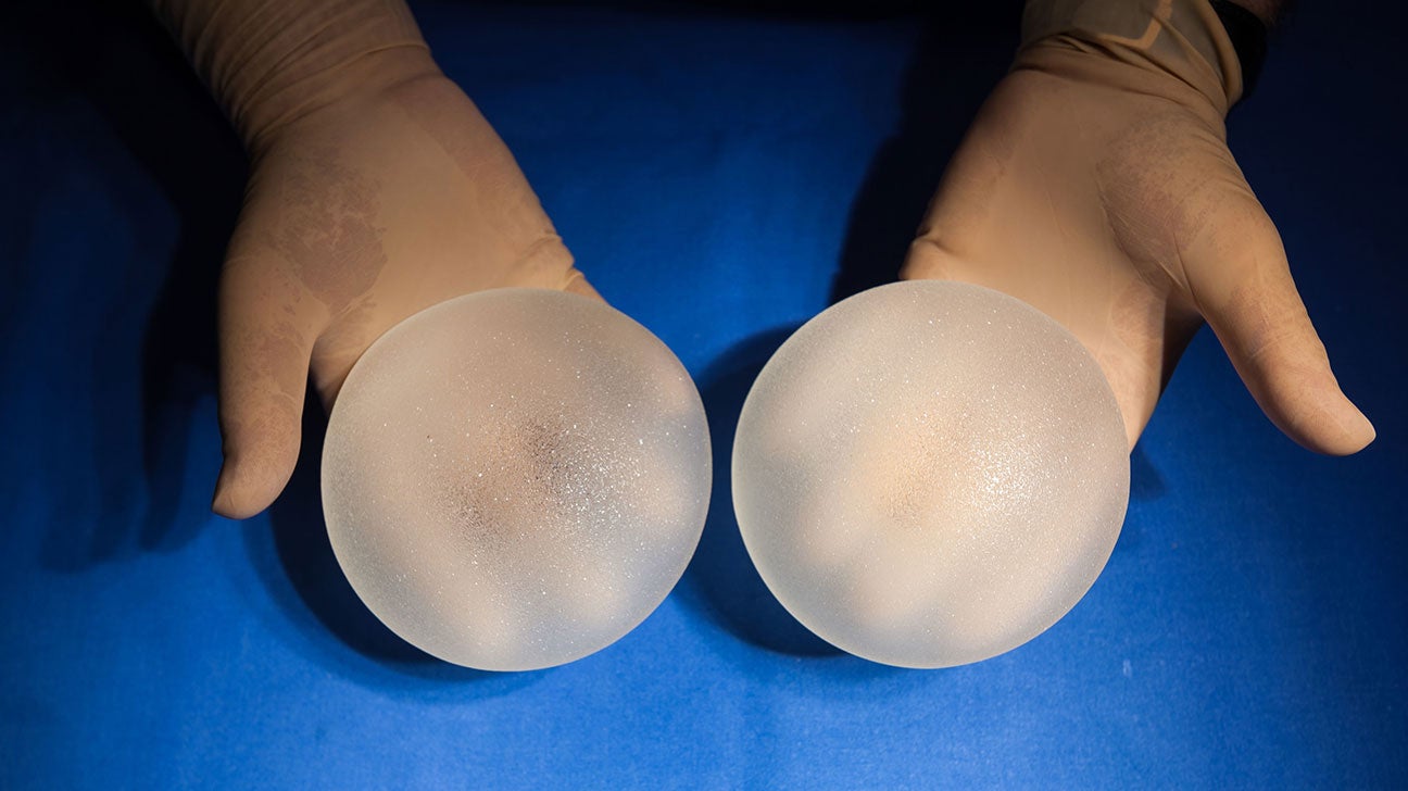 Do You Need a Breast Augmentation of Breast Lift?: Sam W