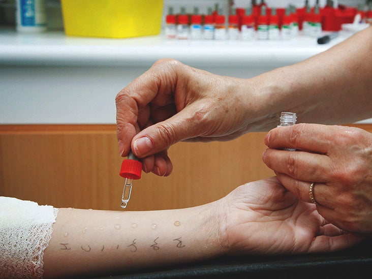 Are At-Home Allergy Tests Worth It?