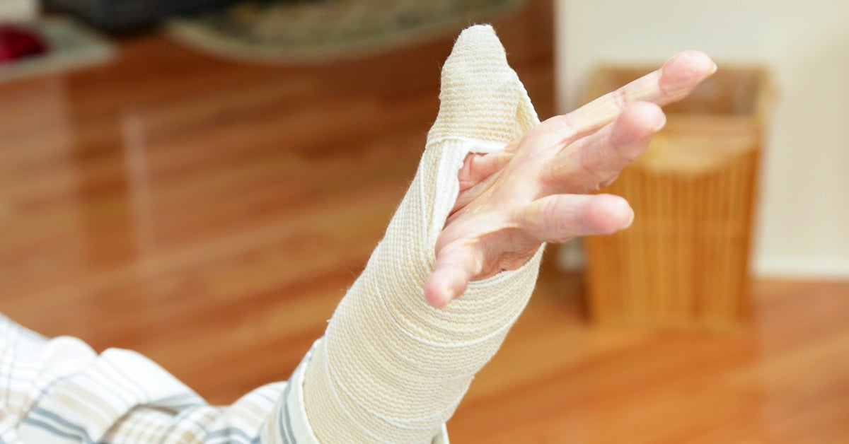 How Long Is Recovery From Thumb Arthritis Surgery