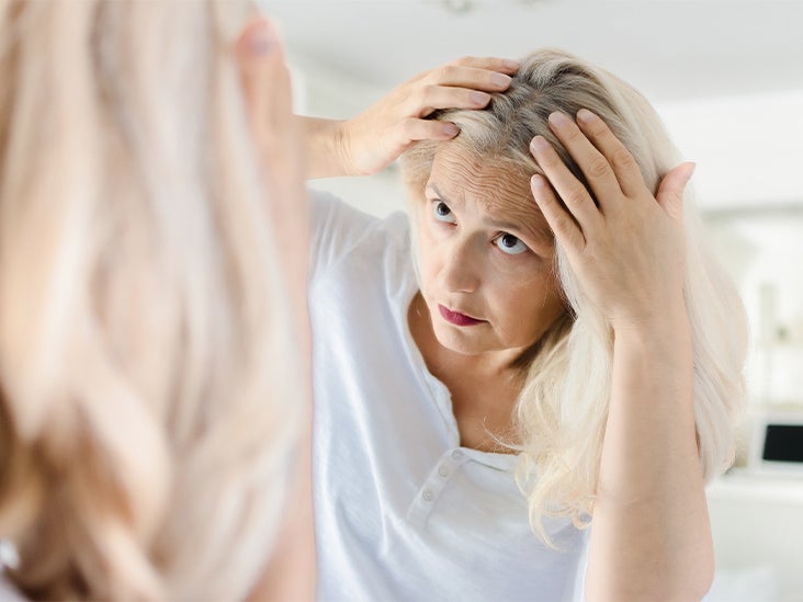 10 Causes Of White Hair And 12 Ways To Prevent It Naturally