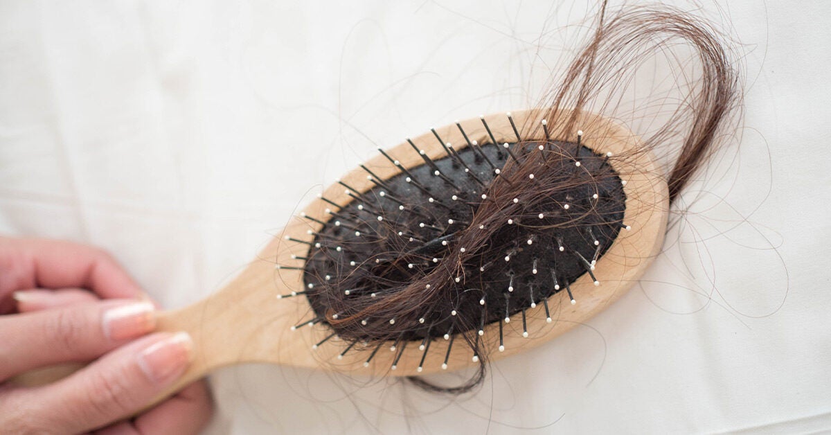 Hair Loss in Women: Causes, Symptoms, Treatments
