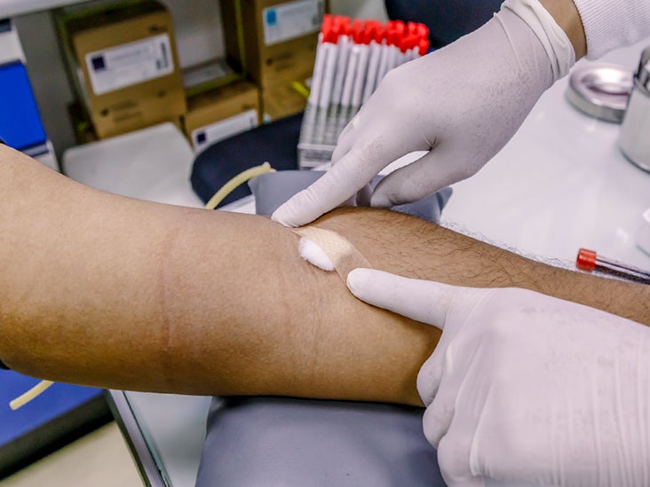 treatment for nerve damage after blood draw