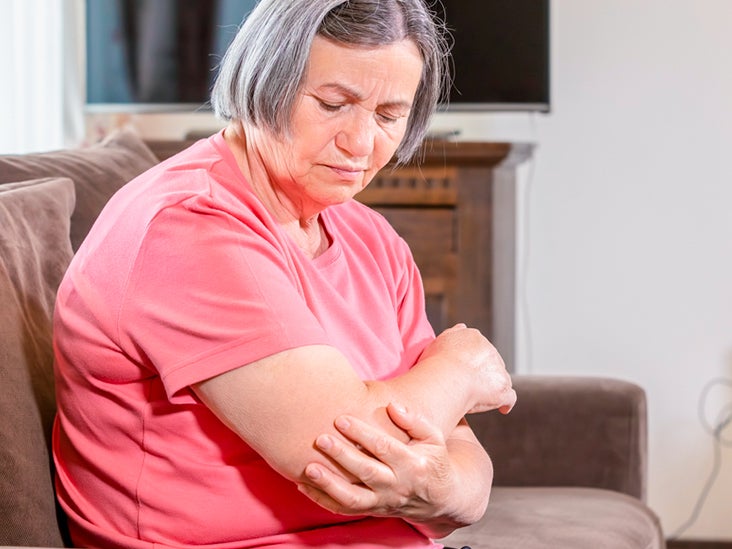 Rheumatoid Arthritis in the Elbow: What to Know