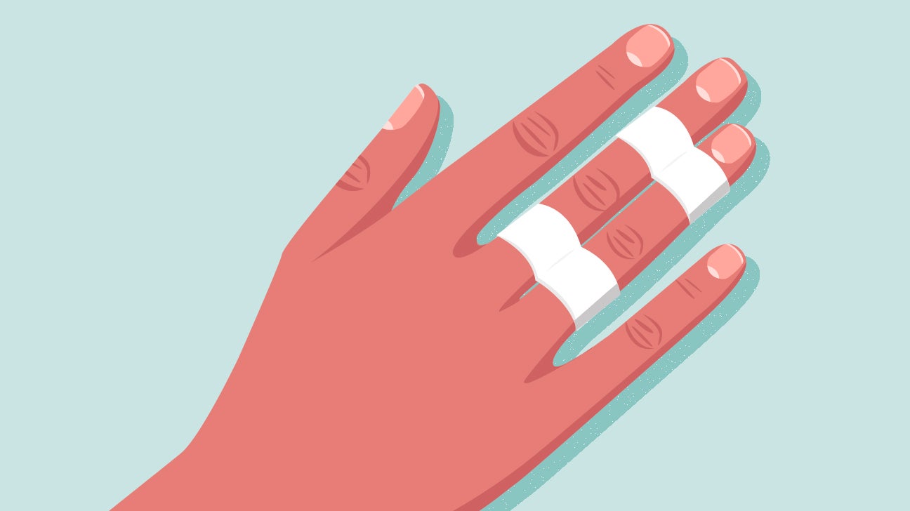 Dødelig vogn smog Buddy Tape: How to Treat a Finger or Toe Injury