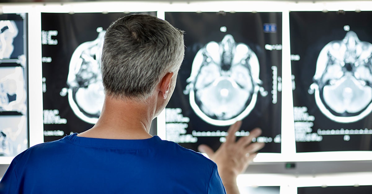 Brain Damage Causes Most Common Types Symptoms Treatment