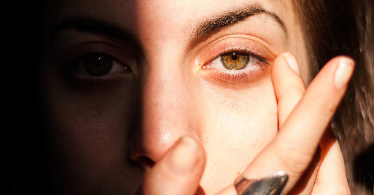 Sunburned Eyes: Causes, Symptoms, and Treatment