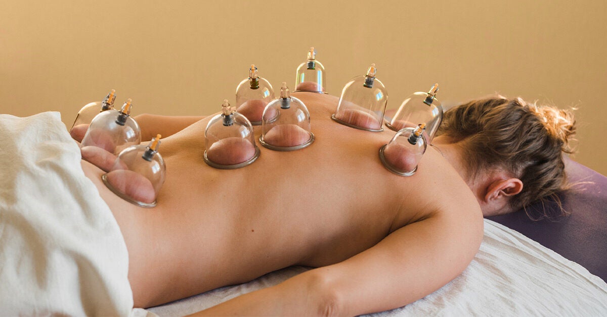 Cupping Treatment