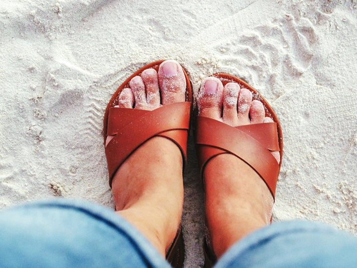 When Rheumatoid Arthritis Affects Your Feet