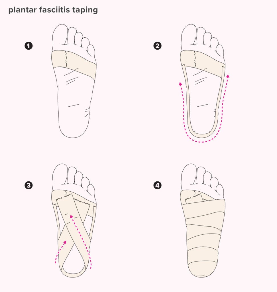 Plantar Fasciitis Taping: Benefits, Materials, How To, and Diagram