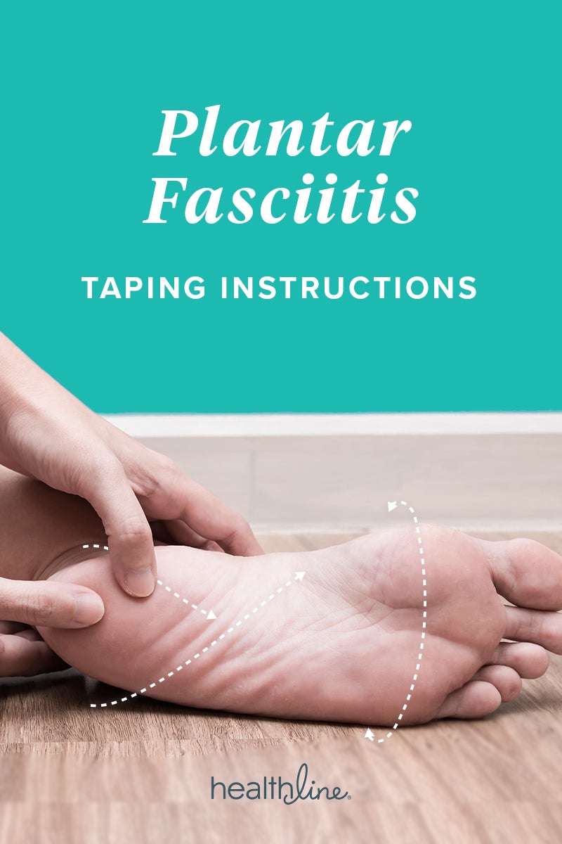 plantar fasciitis taping kt