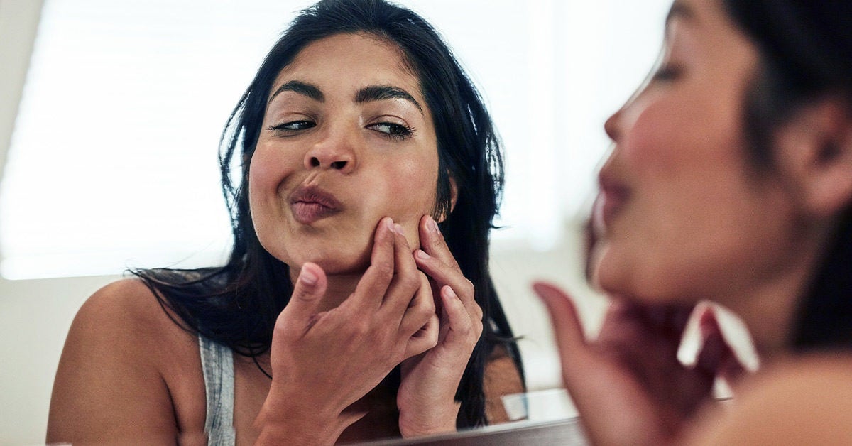 How to Pop a Pimple: Safety, Side Effects, and More