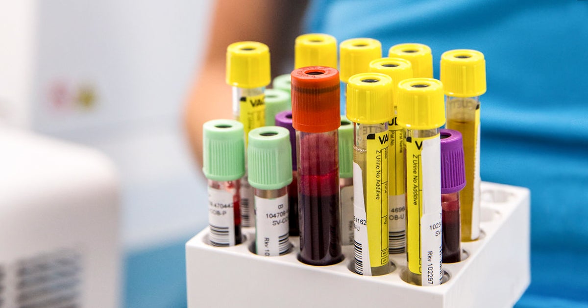 10 Important Blood Tests What They Show Why They re Done More