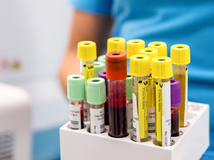 10 Important Blood Tests What They Show Why They Re Done More