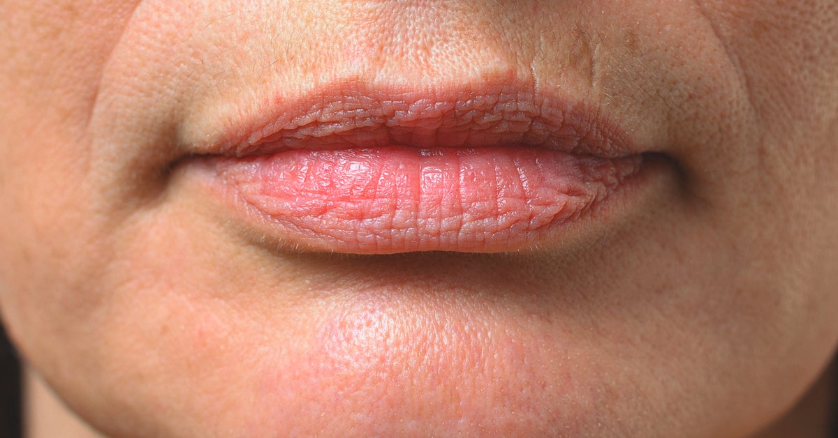 Smoker's Lips: Why You Get Them, How You Can Make Them Go Away