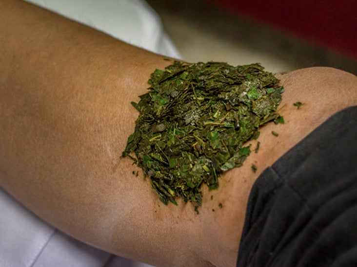 What Is a Poultice and How Can I Use It to Relieve Joint Inflammation?