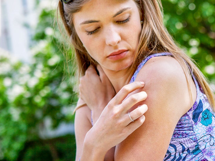 Itchy Skin No Rash Causes Symptoms And Treatments