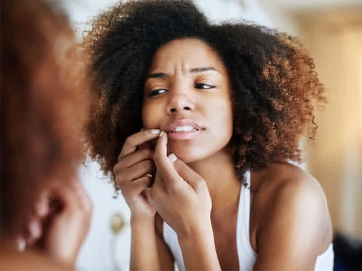 Blind Pimples: What They Are and How to Get Rid of Them