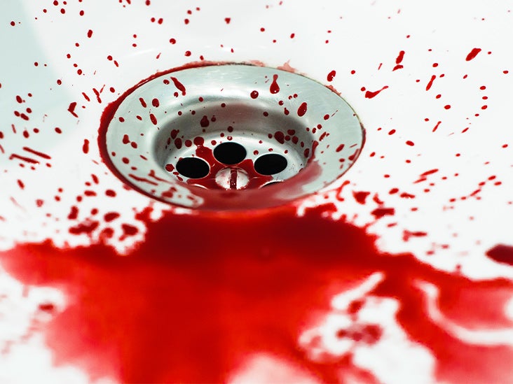 Blood Kink Does Period Sex Count As Play And 15 Other Faqs.