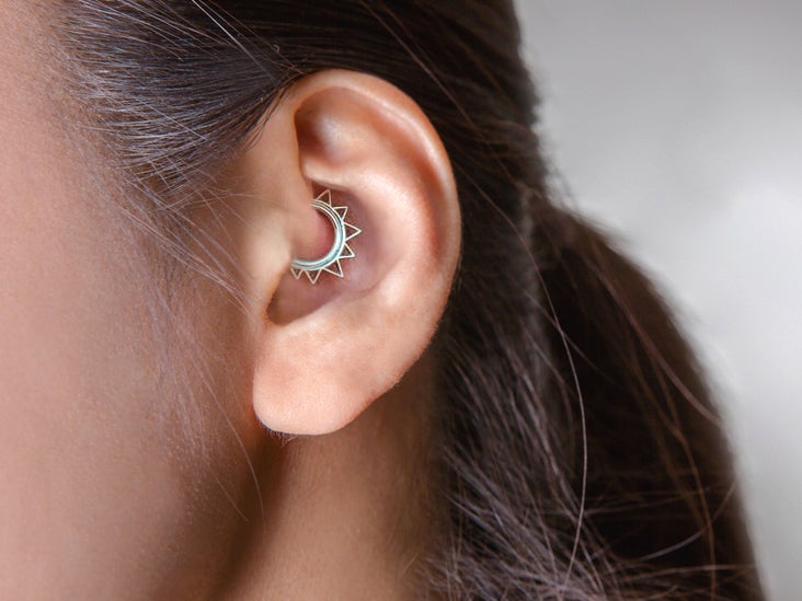 Research on Daith Piercing for Migraines