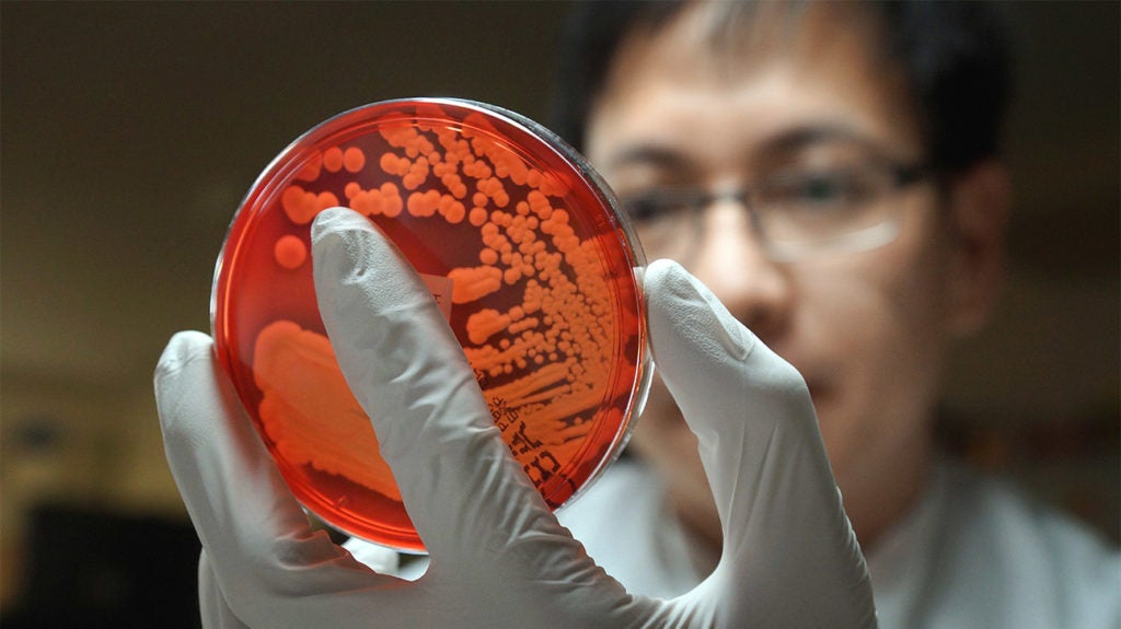 E. coli naeguzogide ọgwụ naahụ n'ime ndị ọrịa 4 NYC Ahụ Ike Ahụ Gị