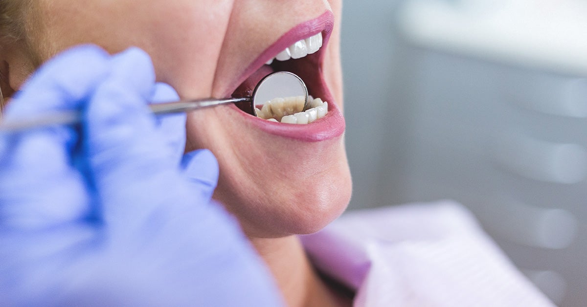 10 Reasons Why All My Teeth Hurt Suddenly