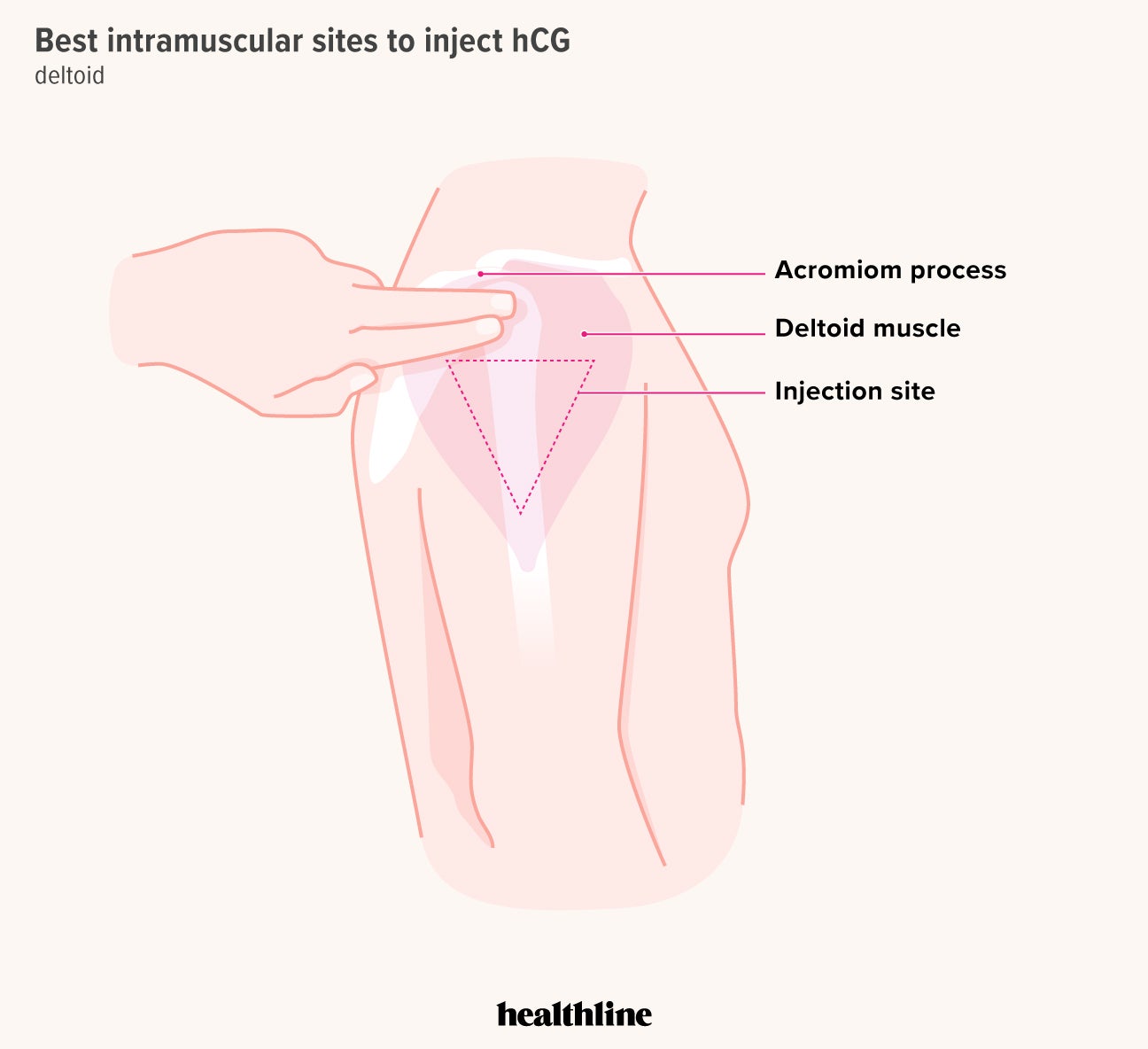 Hcg Injection Dosage Chart