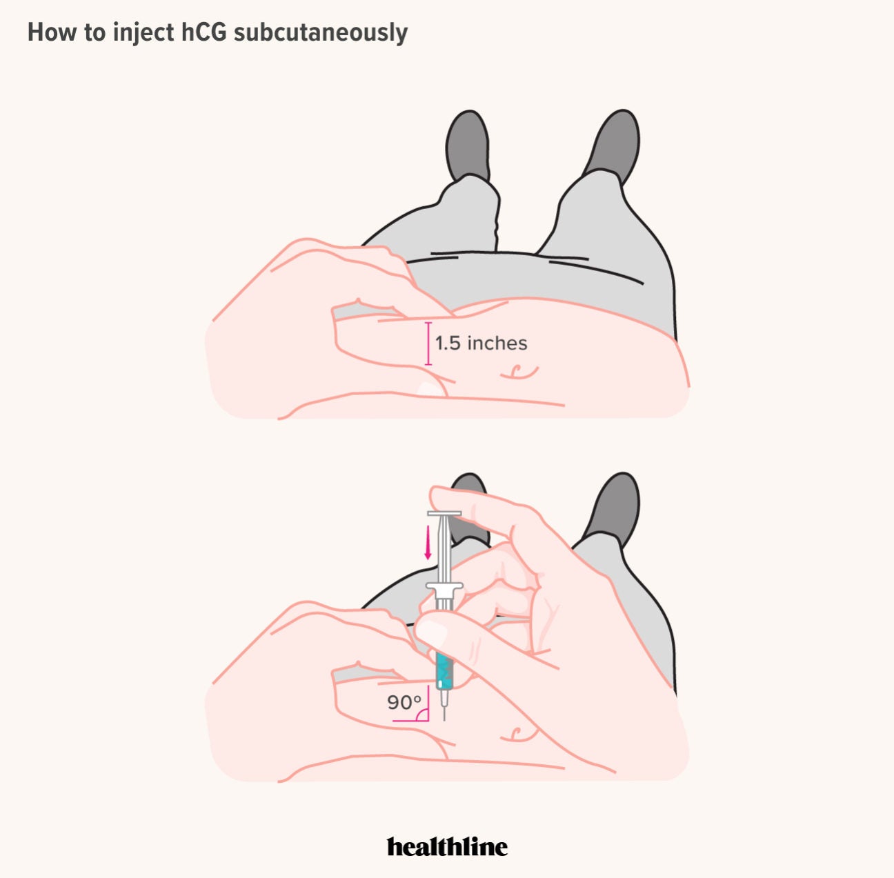 Steps to Self-Injecting HRT/GAHT for IM and SubQ Injections