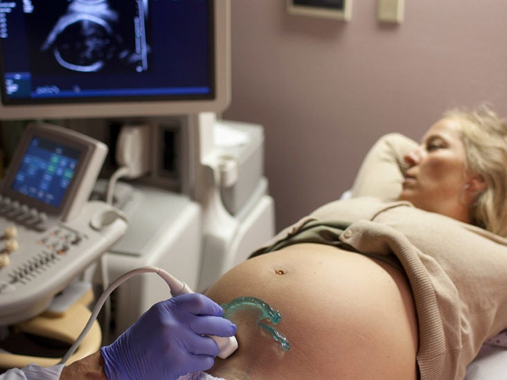 How to Increase Amniotic Fluid: 10 Ways
