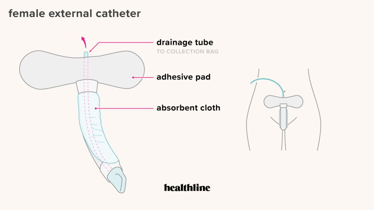 How Does A Catheter Work?  Bladder & Bowel Community