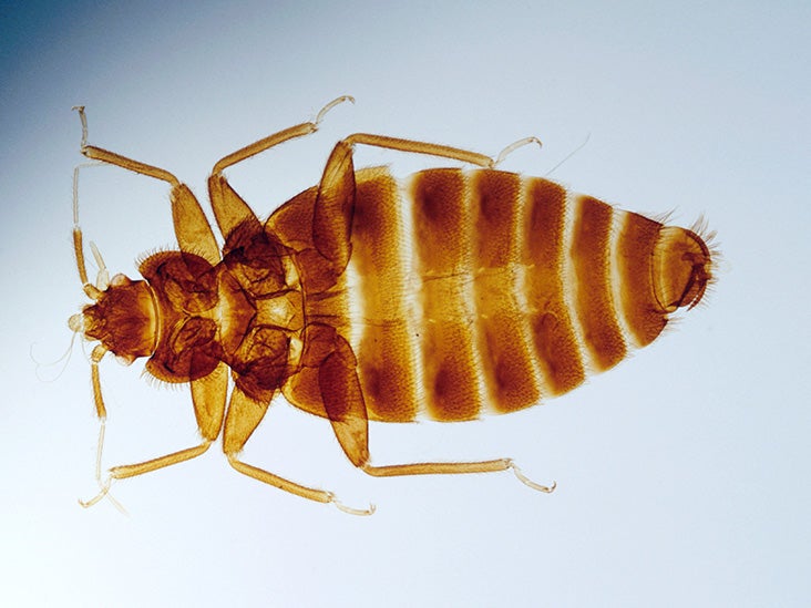 What Causes Bedbugs Tips For, Can Bed Bugs Survive In Plastic