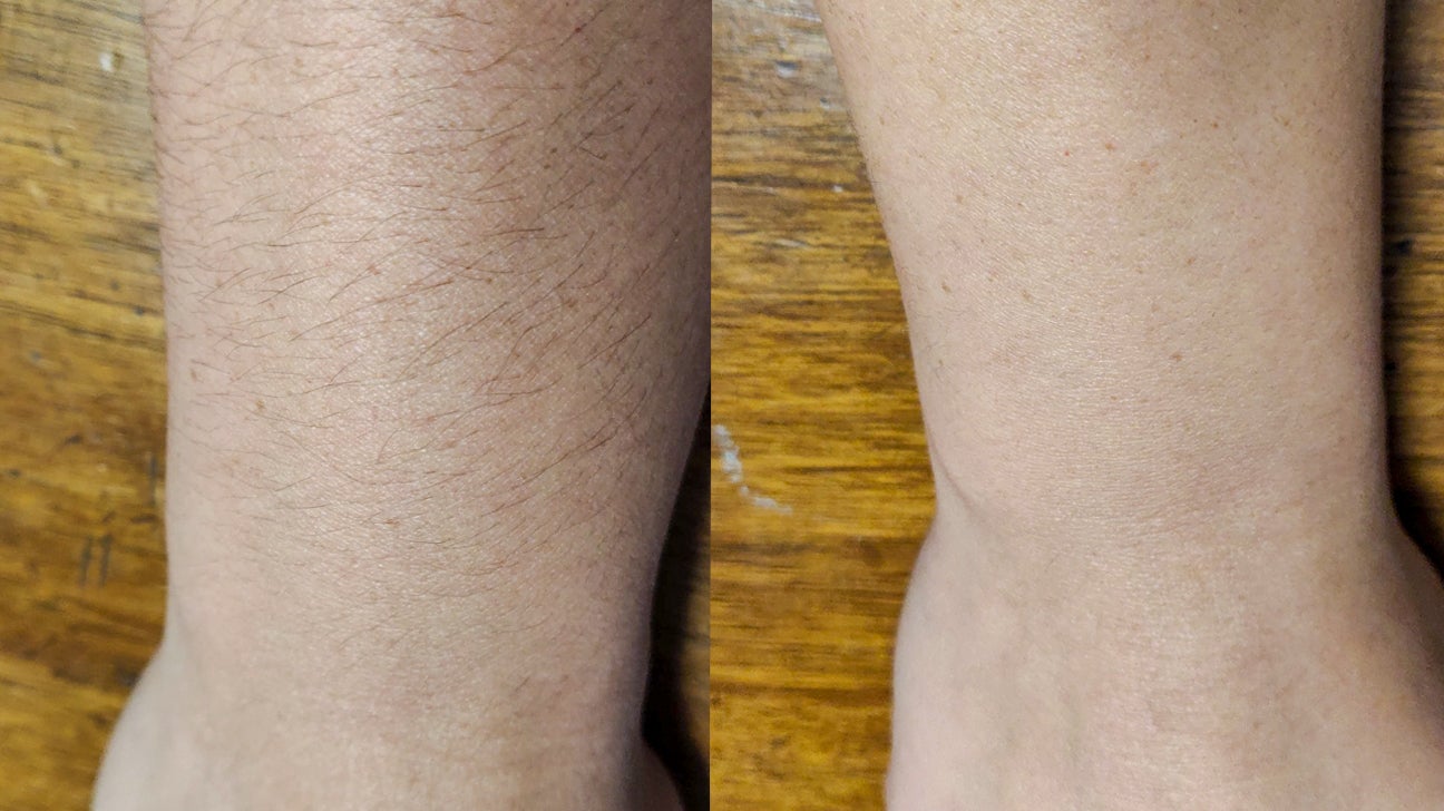Shaving Arms: Pros & Cons, Side Effects, and How to Do It Properly