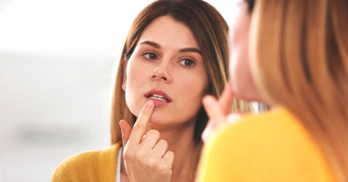 How to Get Rid of a Cold Sore Fast: Treatments and Home Remedies