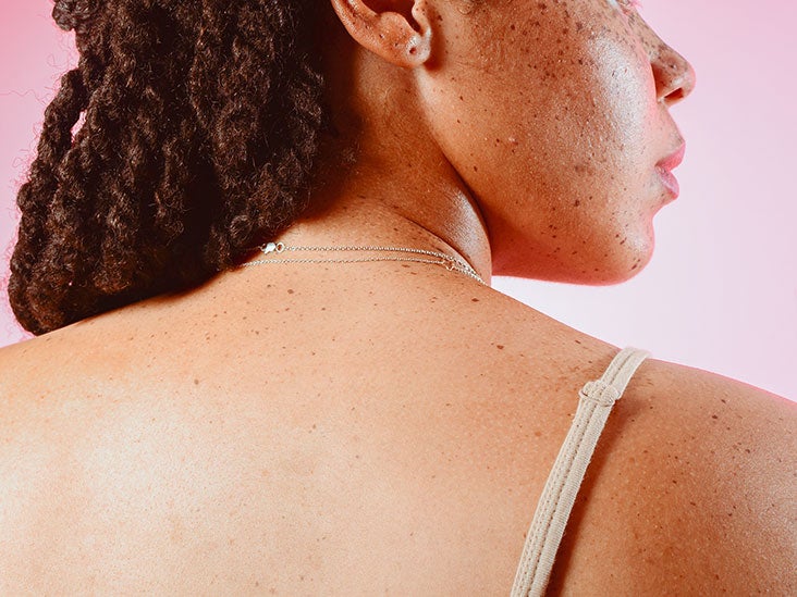 Scientists Just Discovered a “Pain Organ” Under Your Skin