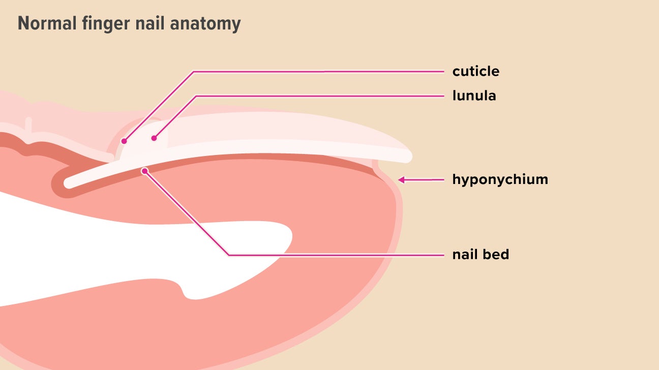 Hyponychium Under Fingernail Skin Thickening Causes And Treatment