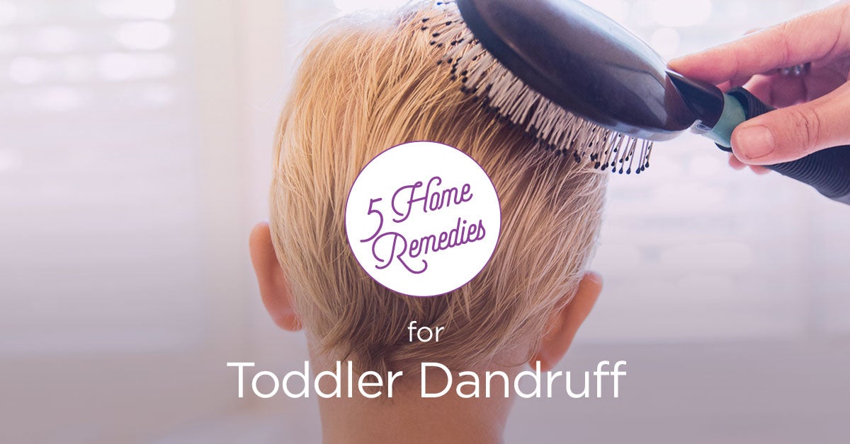 Toddler Dandruff: Home Remedies