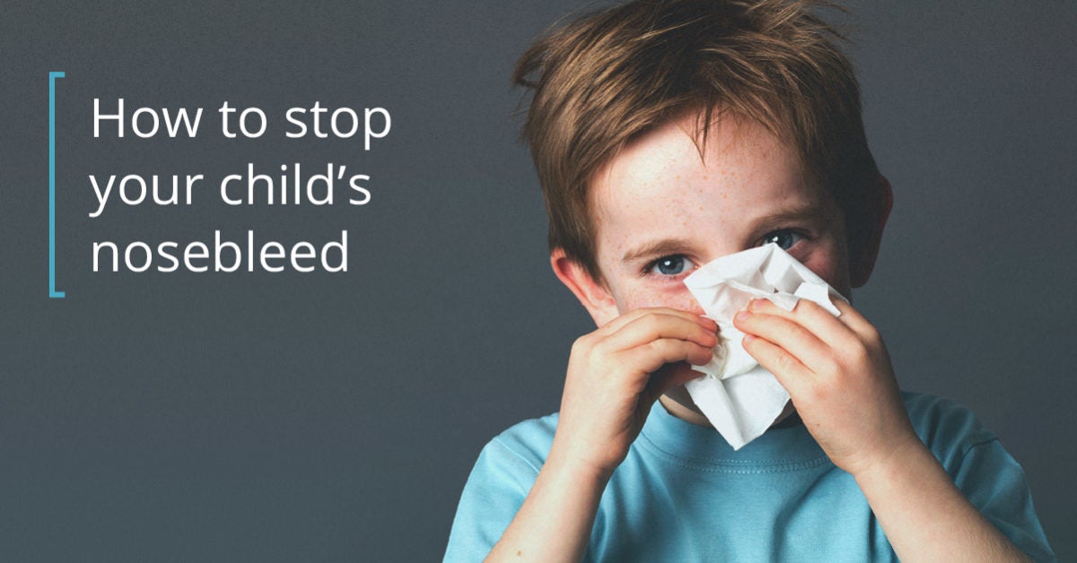 Nosebleeds In Children How To Stop And Prevent