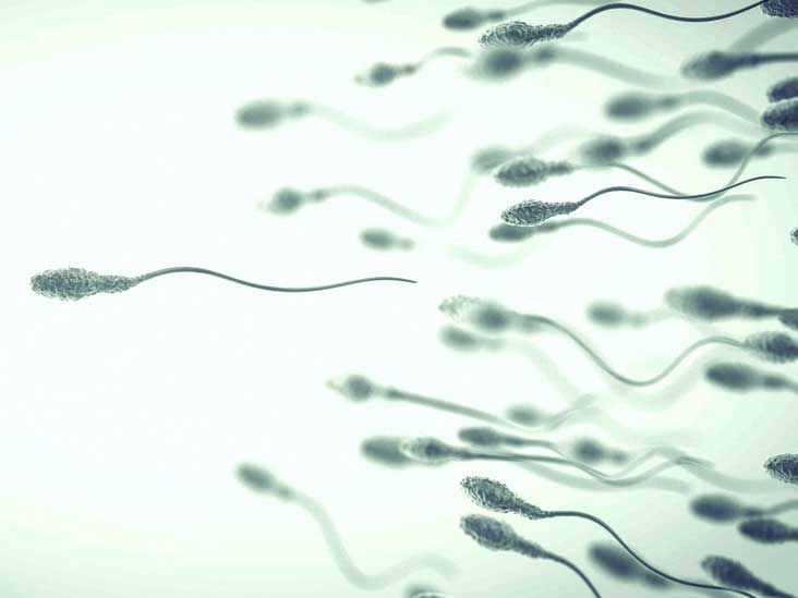 Sperm defect may affect a quarter of worlds men - Mirror 
