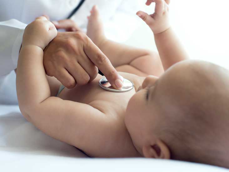 Sandifer Syndrome In Infants Symptoms Causes And Treatment