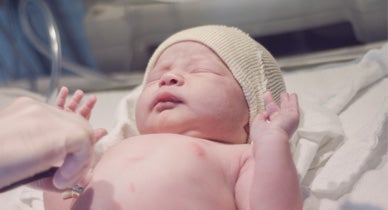 Lotus Birth: Benefits, Risks, What to Expect, and More Lotus Birth: Benefits, Risks, What to Expect, and More