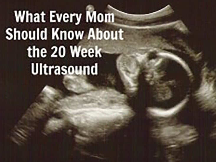 Ultrasound pregnancy pictures of Third Trimester