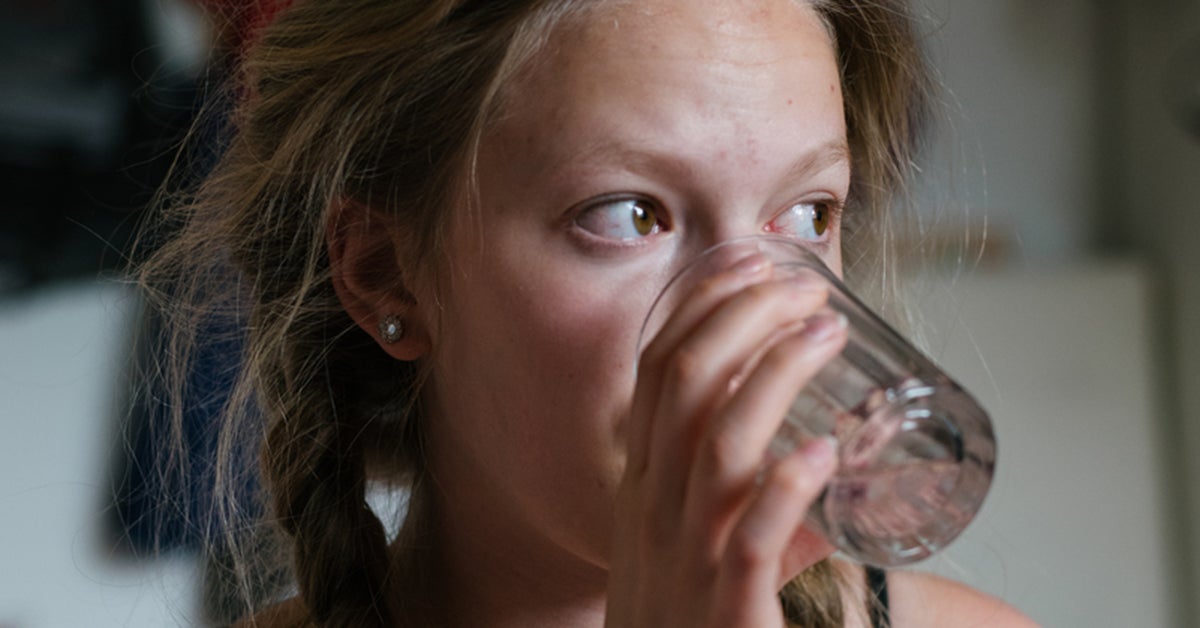 Severe Dehydration: Symptoms, Causes & Treatment
