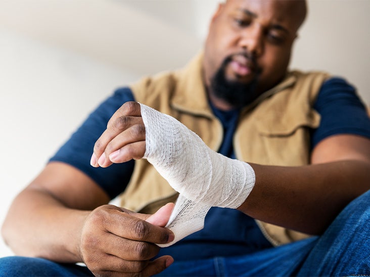 Broken Hand Symptoms, Causes, Diagnosis, and Treatment